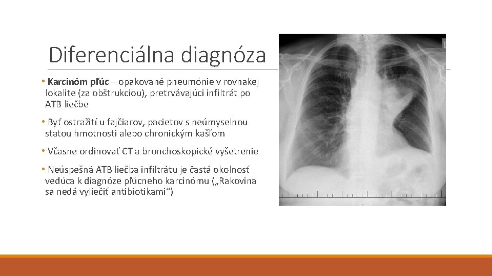 Diferenciálna diagnóza • Karcinóm pľúc – opakované pneumónie v rovnakej lokalite (za obštrukciou), pretrvávajúci