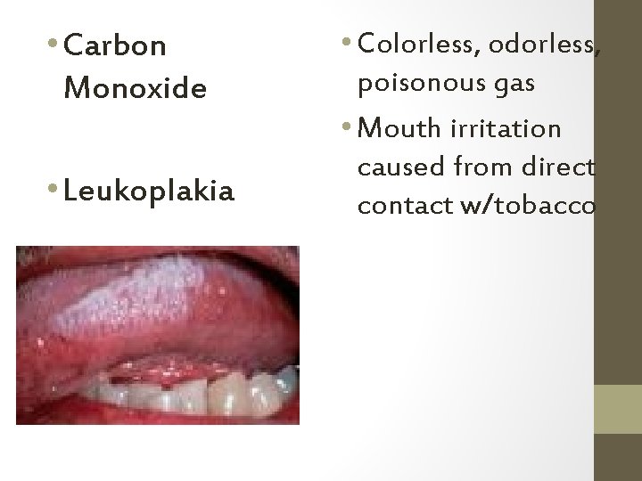  • Carbon Monoxide • Leukoplakia • Colorless, odorless, poisonous gas • Mouth irritation