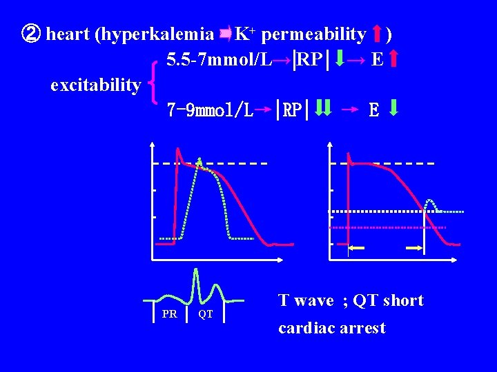② heart (hyperkalemia K+ permeability ) 5. 5 -7 mmol/L→ RP → E excitability