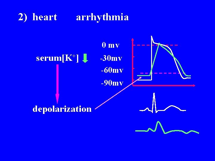 2) heart arrhythmia 0 mv serum[K+] -30 mv -60 mv -90 mv depolarization 