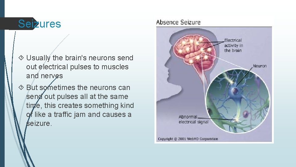 Seizures Usually the brain's neurons send out electrical pulses to muscles and nerves But