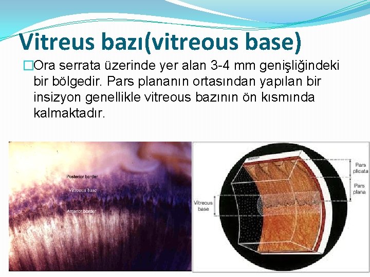 Vitreus bazı(vitreous base) �Ora serrata üzerinde yer alan 3 -4 mm genişliğindeki bir bölgedir.