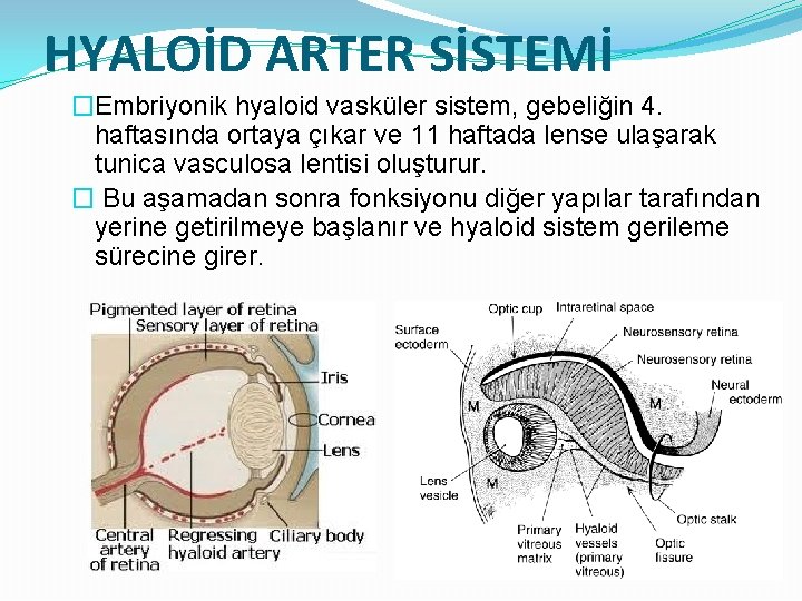 HYALOİD ARTER SİSTEMİ �Embriyonik hyaloid vasküler sistem, gebeliğin 4. haftasında ortaya çıkar ve 11