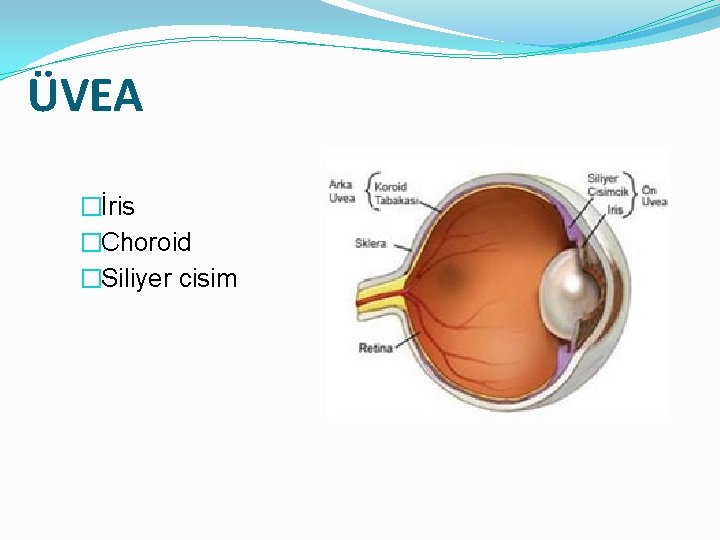 ÜVEA �İris �Choroid �Siliyer cisim 