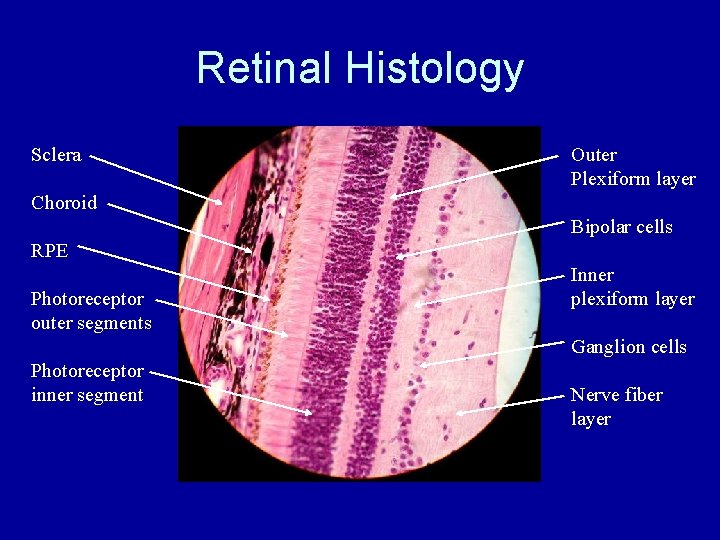 Retinal Histology Sclera Outer Plexiform layer Choroid Bipolar cells RPE Photoreceptor outer segments Inner