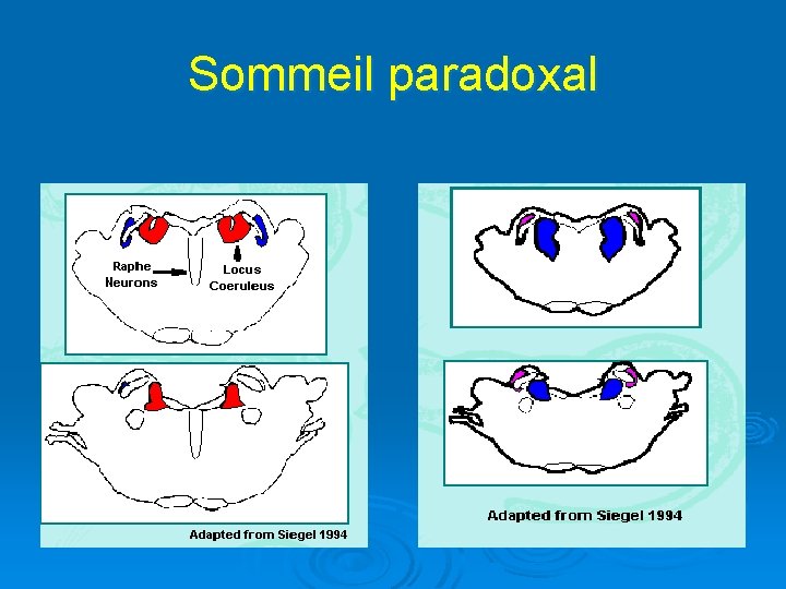 Sommeil paradoxal 