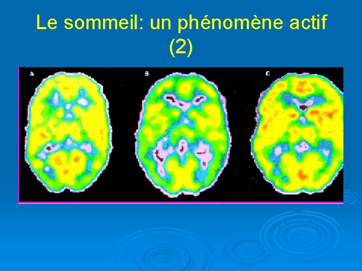 Le sommeil: un phénomène actif (2) 