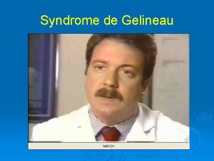 Syndrome de Gelineau 