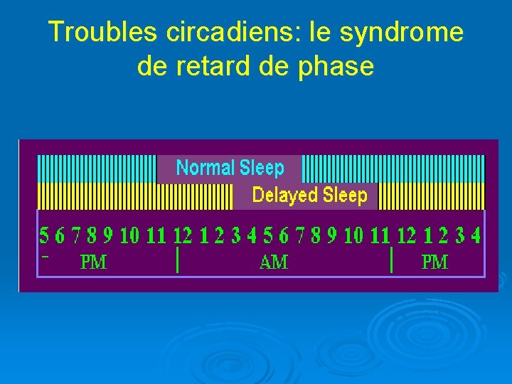 Troubles circadiens: le syndrome de retard de phase 