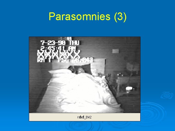 Parasomnies (3) 