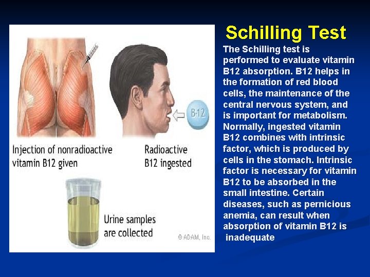 Schilling Test The Schilling test is performed to evaluate vitamin B 12 absorption. B