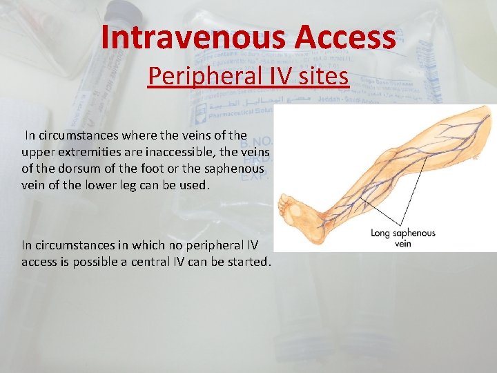 Intravenous Access Peripheral IV sites In circumstances where the veins of the upper extremities