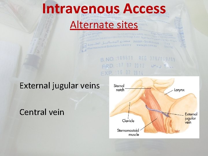 Intravenous Access Alternate sites External jugular veins Central vein 