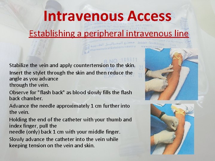 Intravenous Access Establishing a peripheral intravenous line Stabilize the vein and apply countertension to