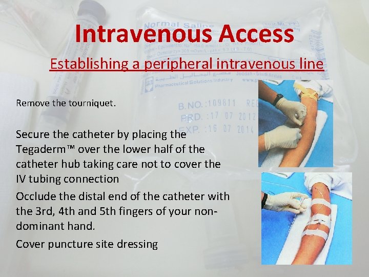 Intravenous Access Establishing a peripheral intravenous line Remove the tourniquet. Secure the catheter by