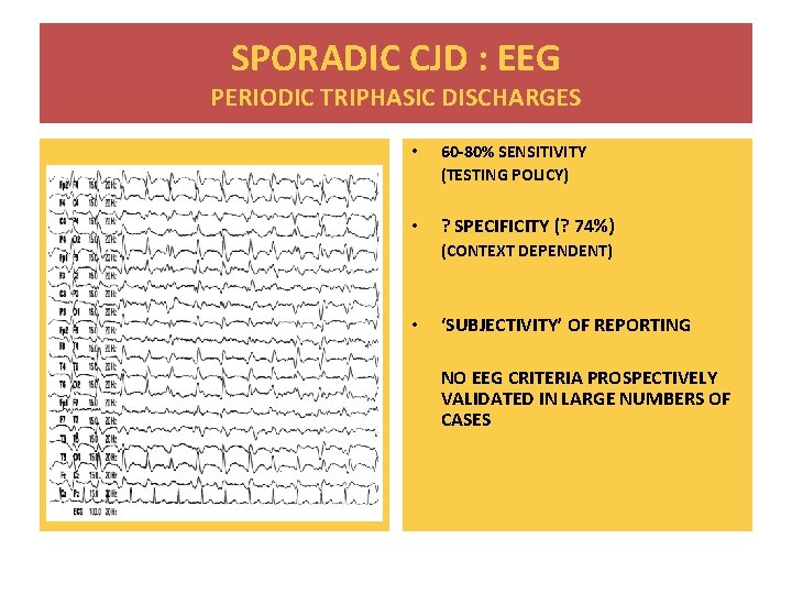 SPORADIC CJD : EEG PERIODIC TRIPHASIC DISCHARGES • 60 -80% SENSITIVITY (TESTING POLICY) •