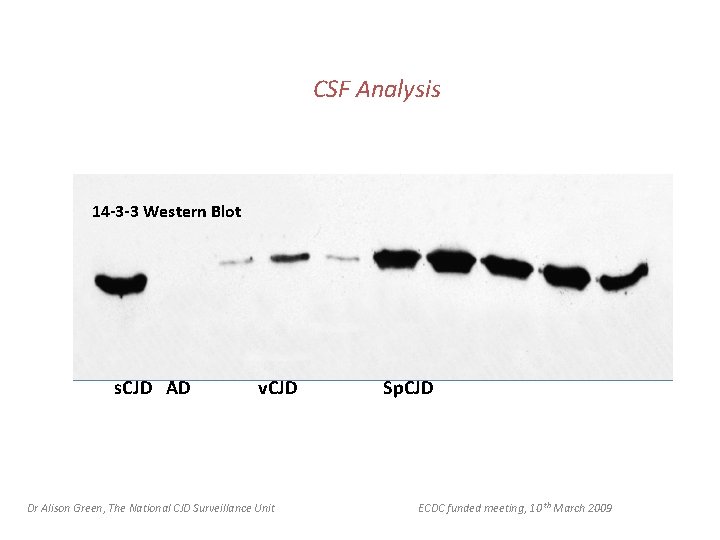 CSF Analysis 14 -3 -3 Western Blot s. CJD AD v. CJD Dr Alison
