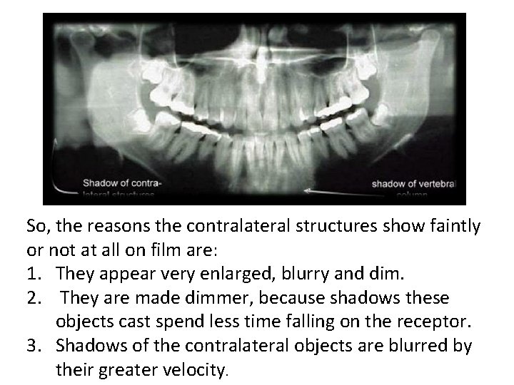 So, the reasons the contralateral structures show faintly or not at all on film
