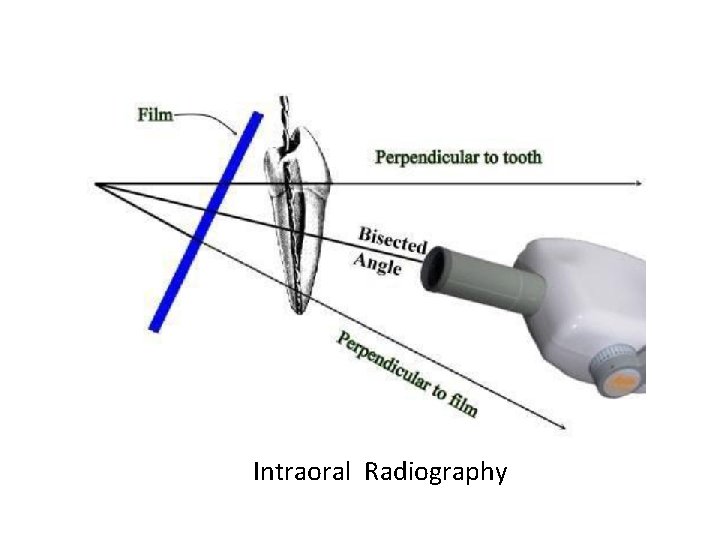 Intraoral Radiography 