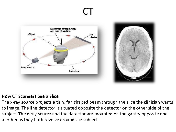 CT How CT Scanners See a Slice The x-ray source projects a thin, fan