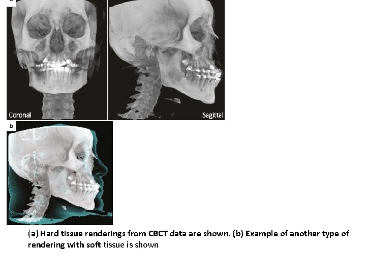 (a) Hard tissue renderings from CBCT data are shown. (b) Example of another type