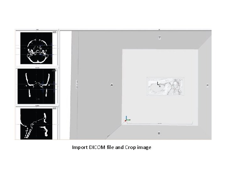 Import DICOM file and Crop image 