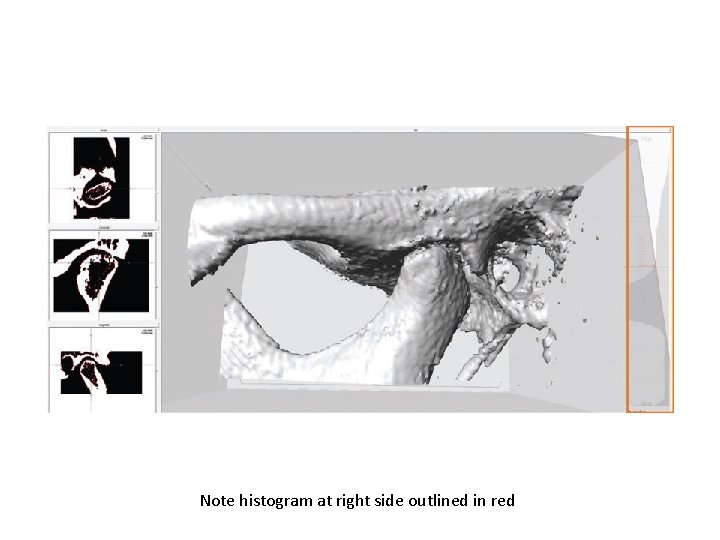 Note histogram at right side outlined in red 