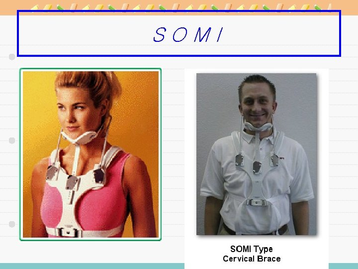 SOMI 