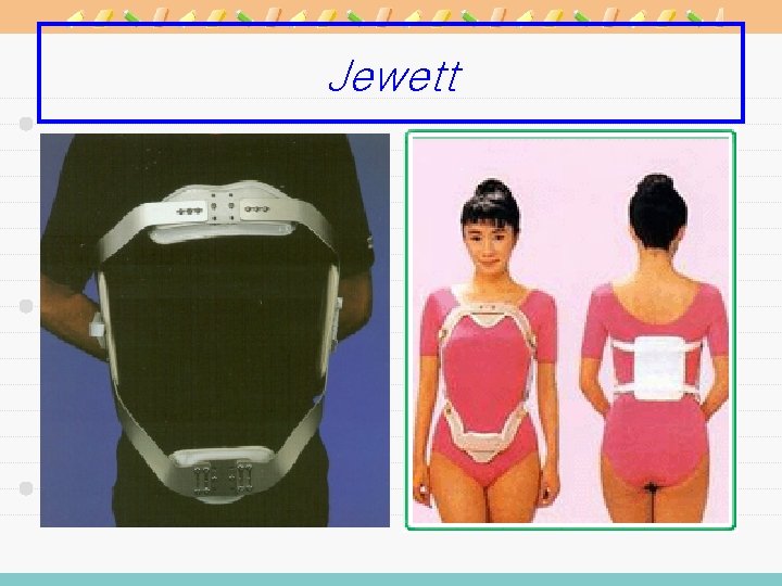 Jewett 
