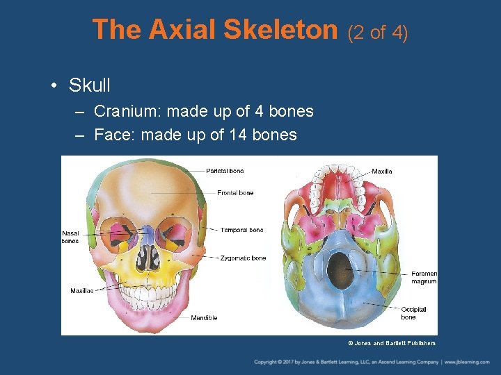 The Axial Skeleton (2 of 4) • Skull – Cranium: made up of 4