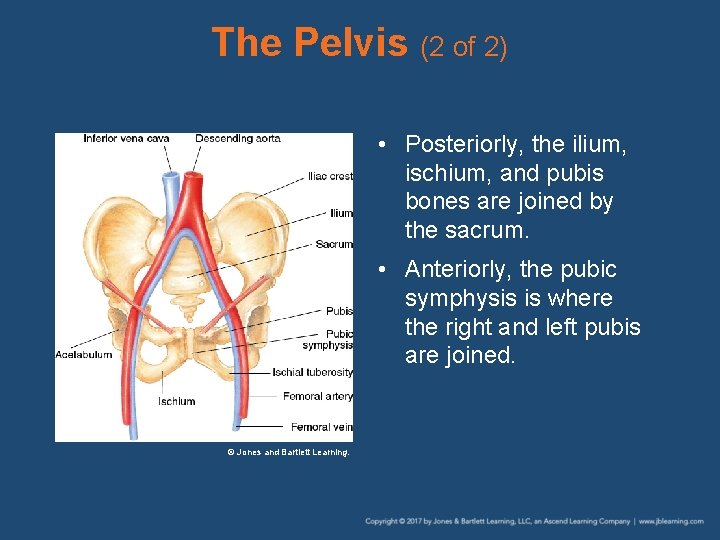 The Pelvis (2 of 2) • Posteriorly, the ilium, ischium, and pubis bones are