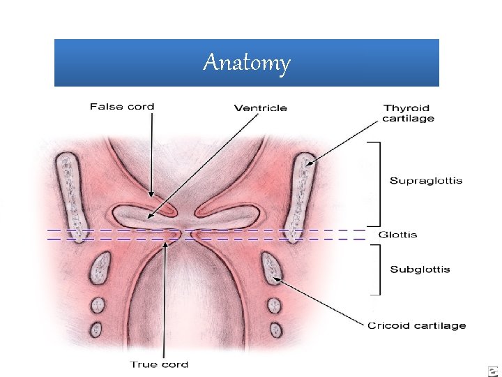 Anatomy • Clinical subdivision – Supraglottis: • from epiglottic tip to floor of laryngeal
