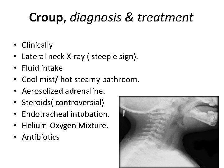 Croup, diagnosis & treatment • • • Clinically Lateral neck X-ray ( steeple sign).