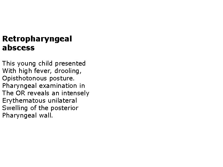 Retropharyngeal abscess This young child presented With high fever, drooling, Opisthotonous posture. Pharyngeal examination