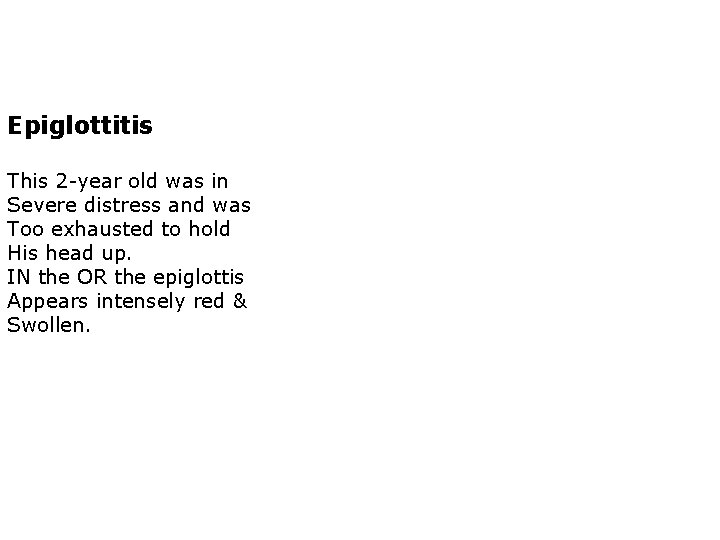 Epiglottitis This 2 -year old was in Severe distress and was Too exhausted to