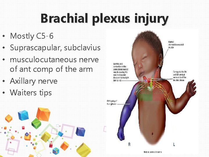 Brachial plexus injury • Mostly C 5 -6 • Suprascapular, subclavius • musculocutaneous nerve