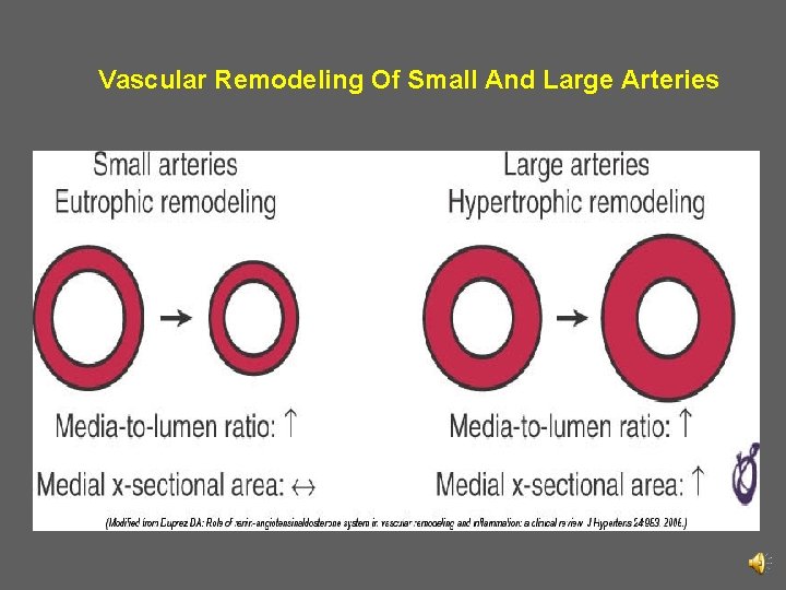 Vascular Remodeling Of Small And Large Arteries 