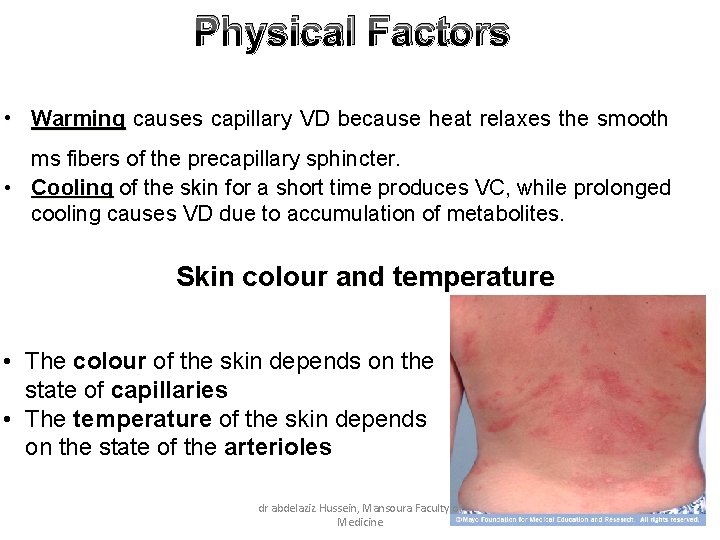 Physical Factors • Warming causes capillary VD because heat relaxes the smooth ms fibers