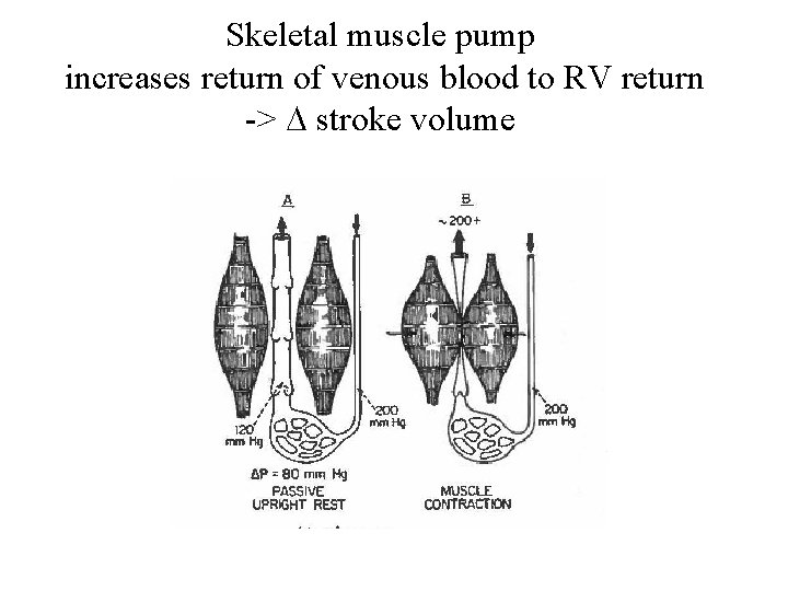 Skeletal muscle pump increases return of venous blood to RV return -> D stroke