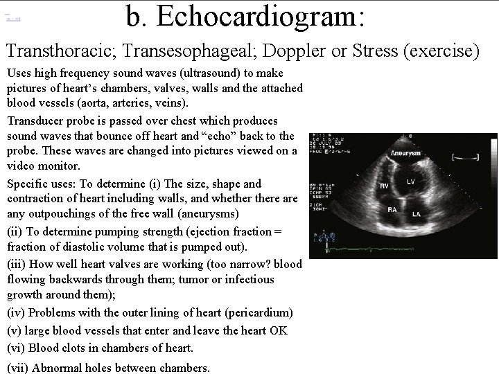 320 × 228 b. Echocardiogram: Transthoracic; Transesophageal; Doppler or Stress (exercise) Uses high frequency