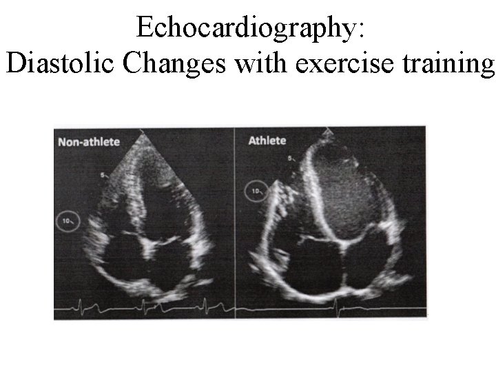 Echocardiography: Diastolic Changes with exercise training 