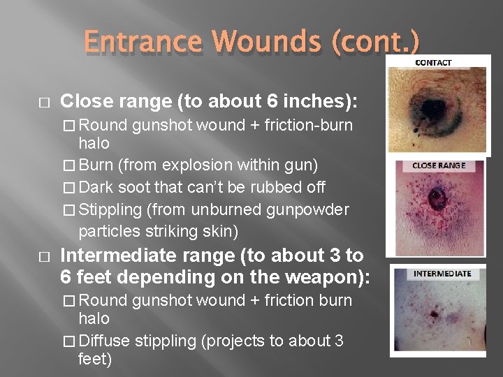 Entrance Wounds (cont. ) � Close range (to about 6 inches): � Round gunshot