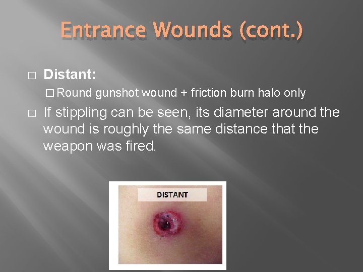 Entrance Wounds (cont. ) � Distant: � Round � gunshot wound + friction burn