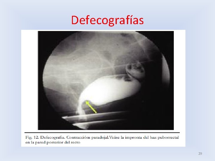 Defecografías 29 