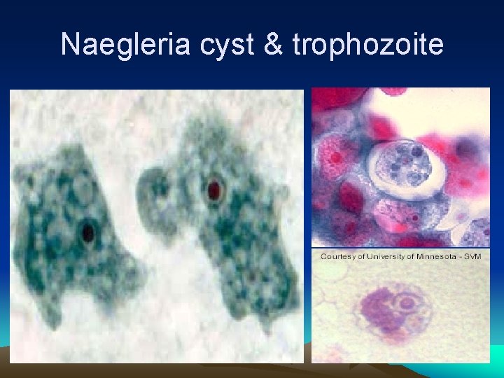 Naegleria cyst & trophozoite 