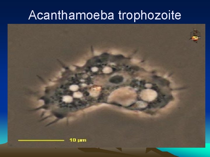 Acanthamoeba trophozoite 