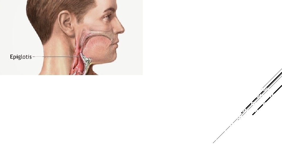  Epiglotis merupakan susunan tulang rawan yang terletak di belakang lidah dan terletak di