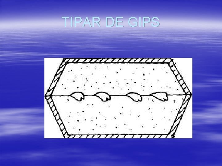 TIPAR DE GIPS 