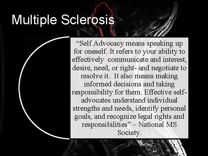 Multiple Sclerosis “Self Advocacy means speaking up for oneself. It refers to your ability