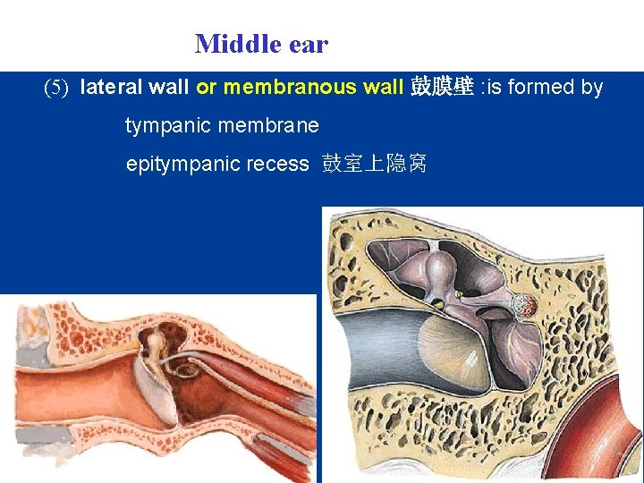 Middle ear (5) lateral wall or membranous wall 鼓膜壁 : is formed by tympanic